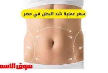 سعر عملية شد البطن في مصر