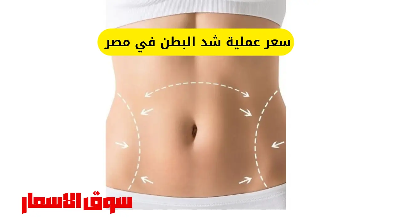 سعر عملية شد البطن في مصر