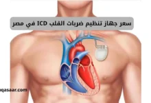 سعر جهاز تنظيم ضربات القلب ICD في مصر