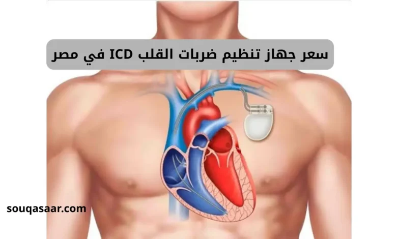 سعر جهاز تنظيم ضربات القلب ICD في مصر