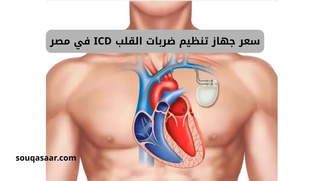 سعر جهاز تنظيم ضربات القلب ICD في مصر