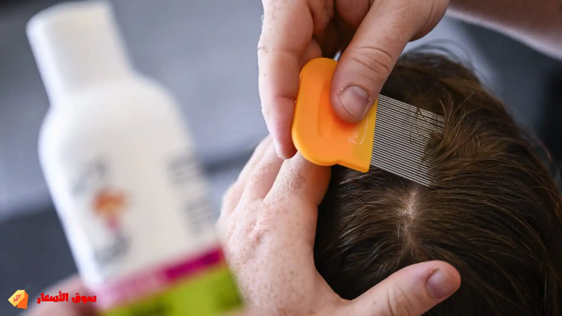 لماذا يفشل علاج القمل في المنزل