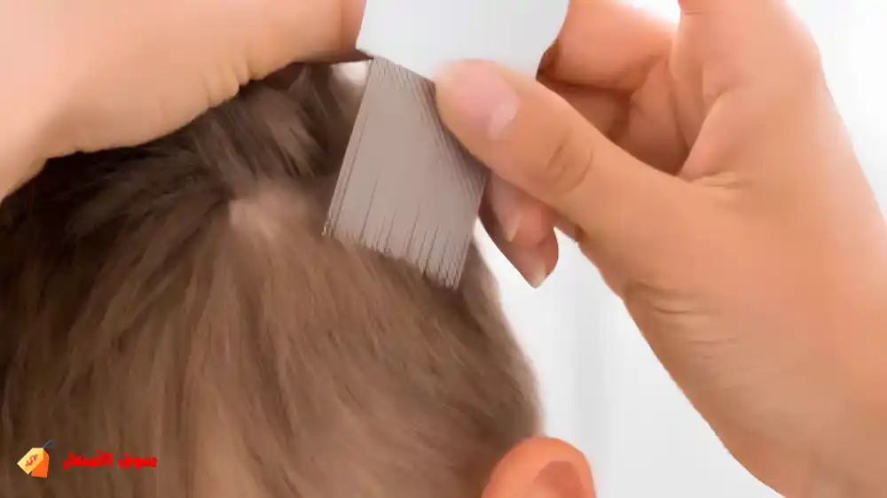 كيف تتصرف الأسرة عند اكتشاف القمل